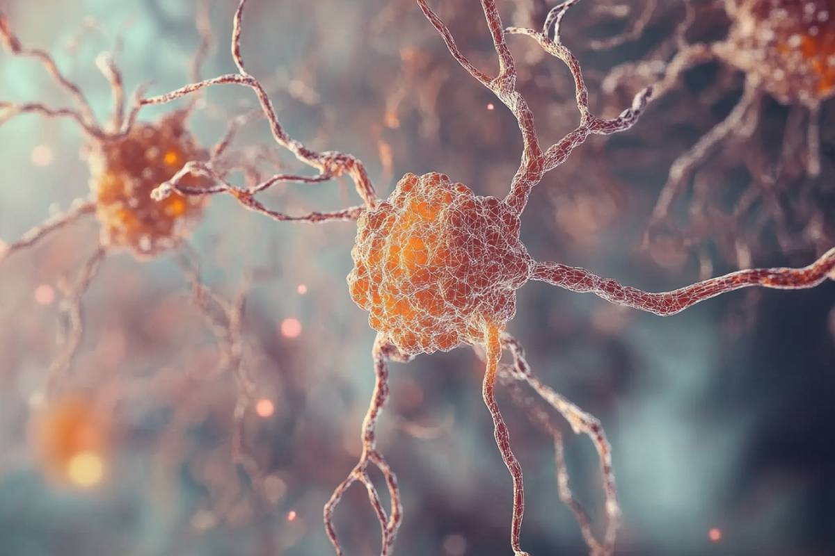 Avances Recientes en la Investigación Genética sobre el Parkinson